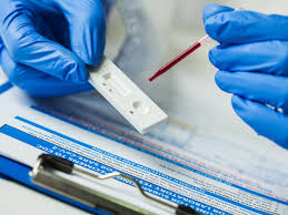 Distribution de tests de diagnostic rapides